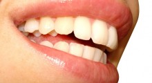 sonrisa