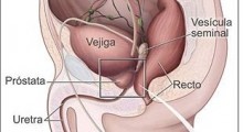 Prostata